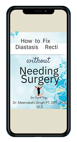 How to Fix Diastasis Recti without Needing Surgery
